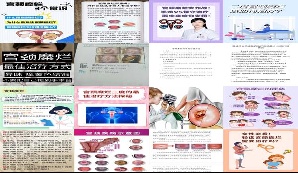汕头哪个医院治疗宫颈*好 - 汕头宫颈糜烂治疗方法